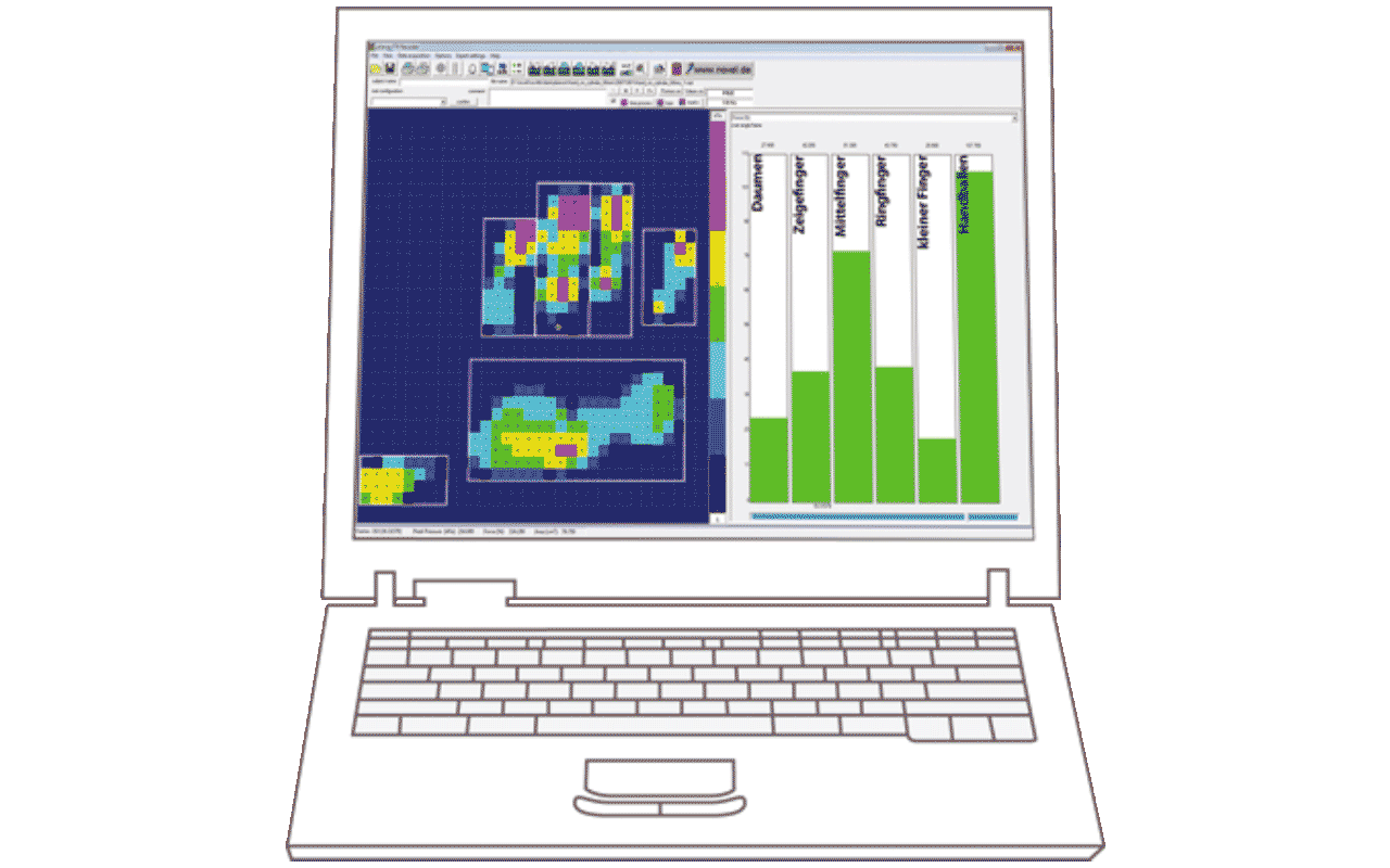 illustrated computer showing hand diagnostics